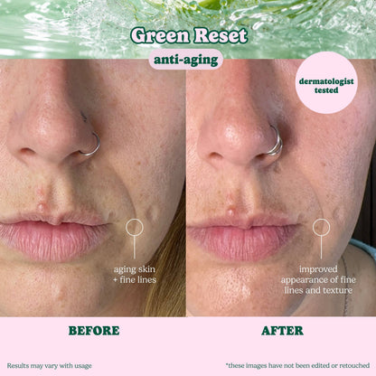 Evergreen Reset Anti-Aging Sheet Mask